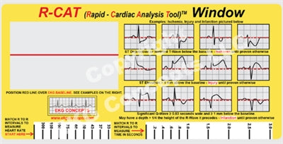 R-CAT EKG Window