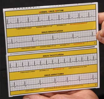 R-CAT for Arrhythmias with FREE R-CAT EKG Badge